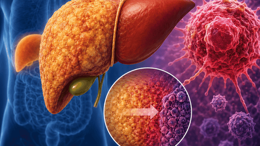 Fatty Liver Disease and Cancer Risk: What You Need to Know